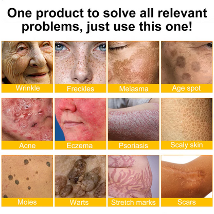 📦📦📦TGA Approved: Ourlyard® Bee venom Pro Comprehensive Cream — 🔥Limited Time 80% OFF🔥