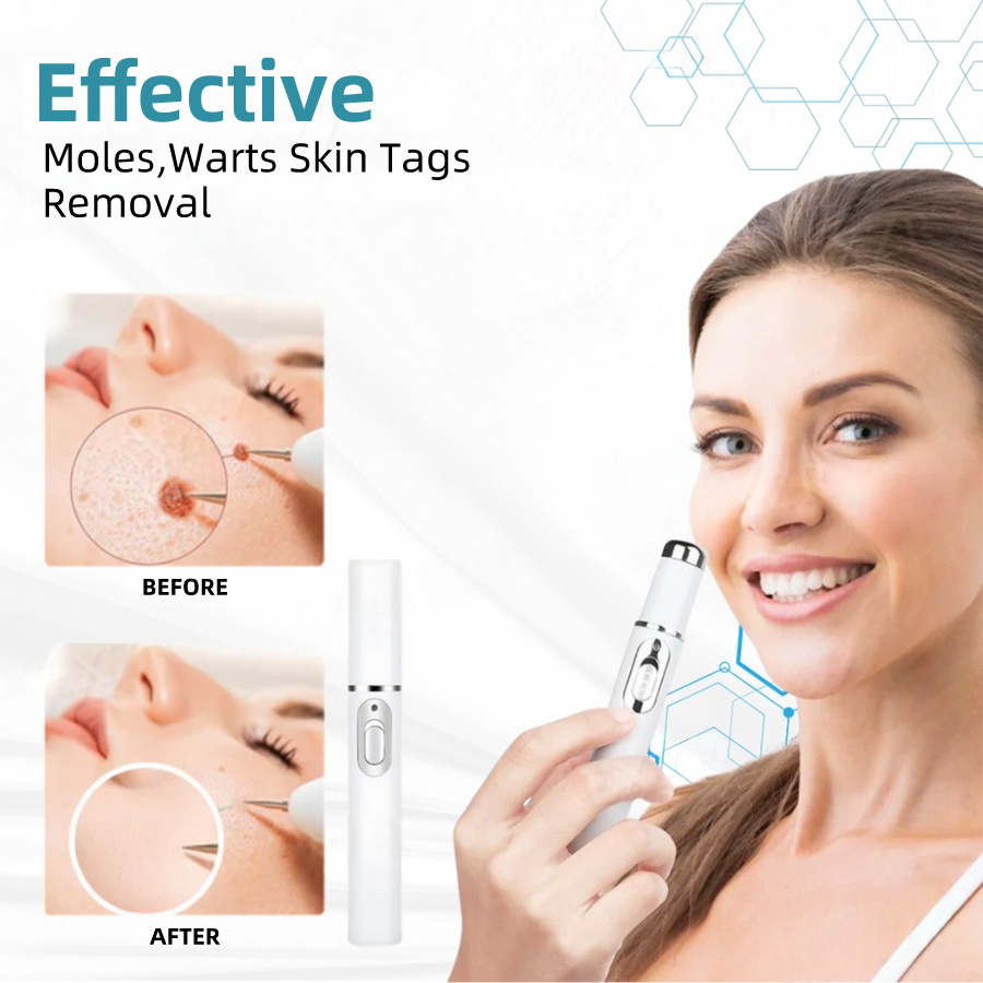 𝐉𝐚𝐬𝐬𝐞𝐞𝐦® Medical-Grade Laser Pen 🔥 (Powered by CO₂ laser technology – effectively removes moles, warts, skin tags, pigmentation spots, and other skin imperfections)🏆
