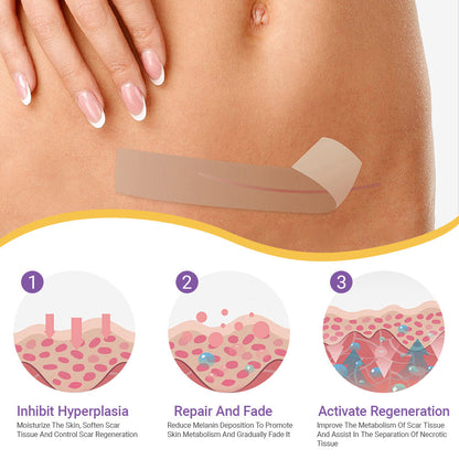 ✅Official Store |Ourlyard® Hyaluronic Acid Nano Microneedle Repair Tape🦘🏥(Treatment of old and new scars, reduction of surgical scars, stretch marks, keloids, acne, burns, warts, dermatomes and varicose veins)