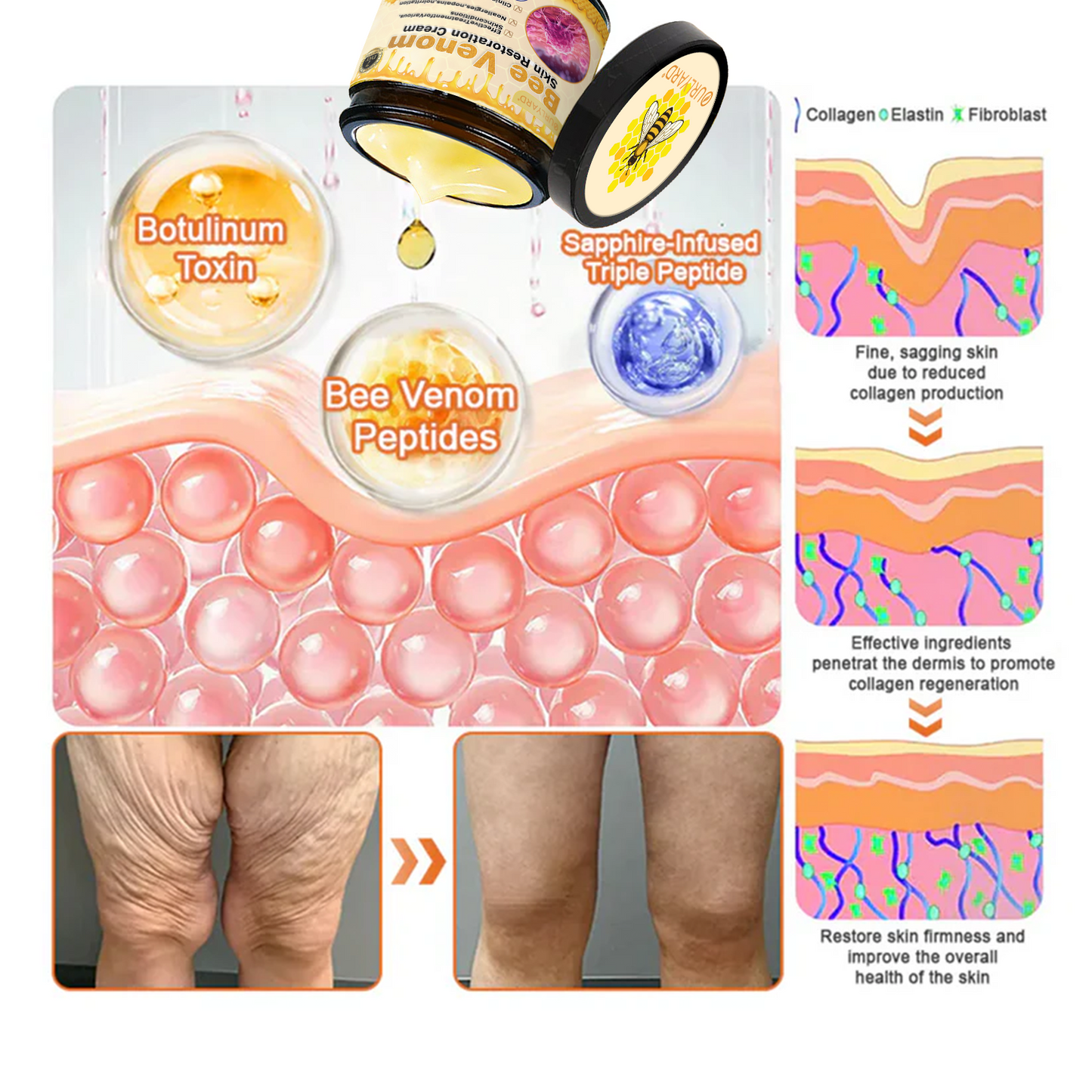 📦📦📦TGA Approved: Ourlyard® Bee venom Pro Comprehensive Cream — 🔥Limited Time 80% OFF🔥