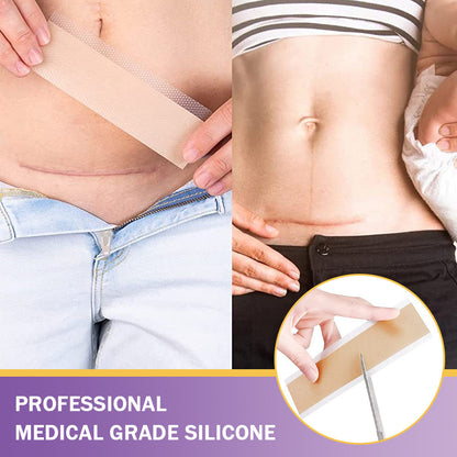 ✅Official Store |Ourlyard® Hyaluronic Acid Nano Microneedle Repair Tape🦘🏥(Treatment of old and new scars, reduction of surgical scars, stretch marks, keloids, acne, burns, warts, dermatomes and varicose veins)